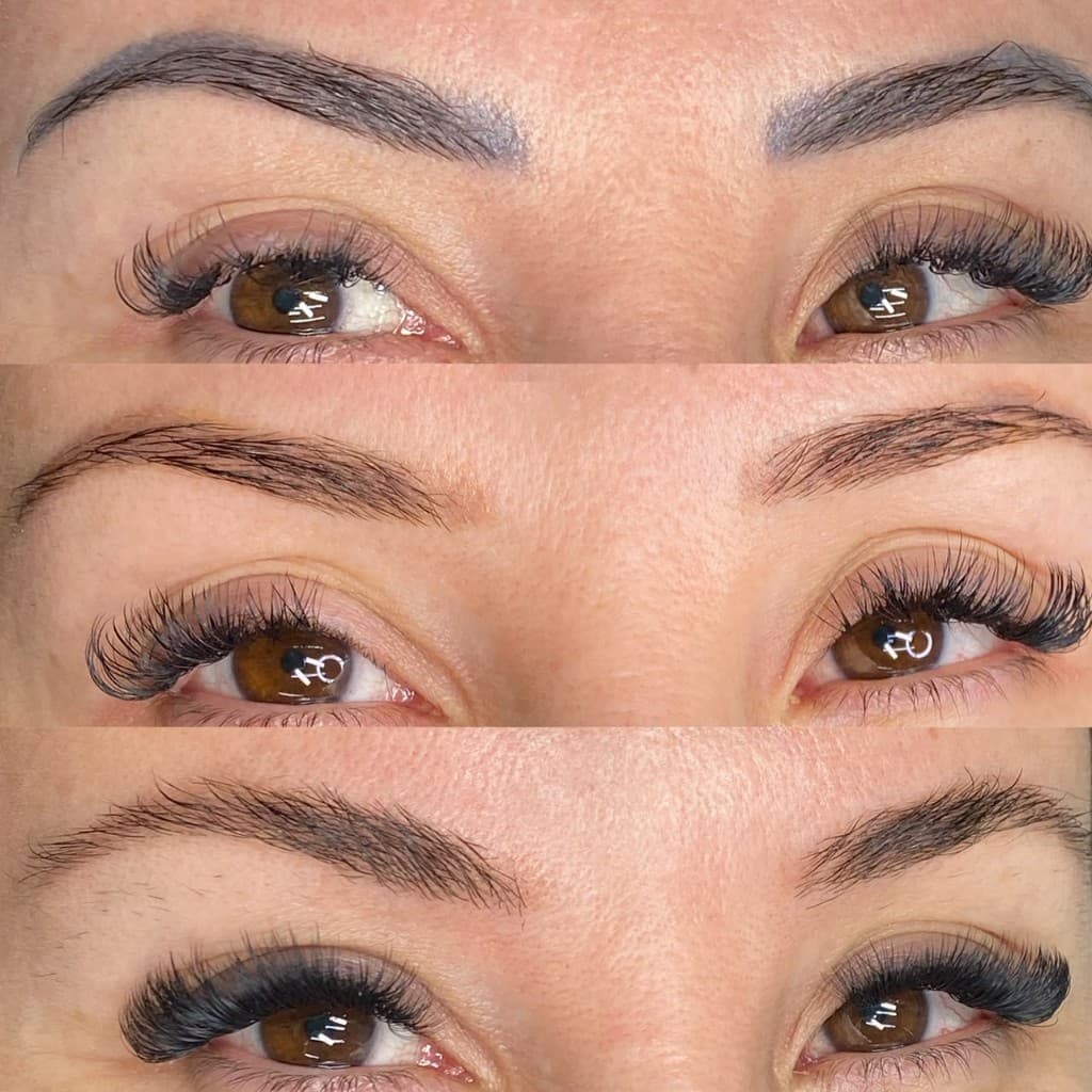 Antes e depois de remoção a laser — caso 2