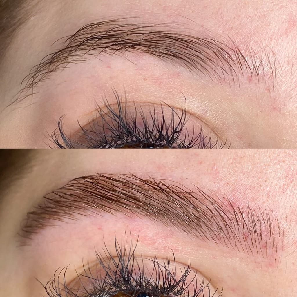 Antes e depois de micropigmentação — caso 2