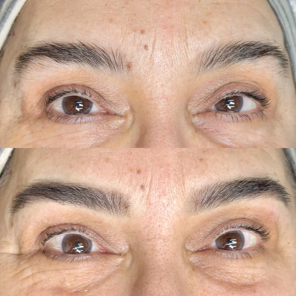 Antes e depois de micropigmentação — caso 3