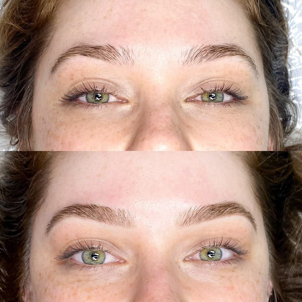 Antes e depois de micropigmentação — caso 4