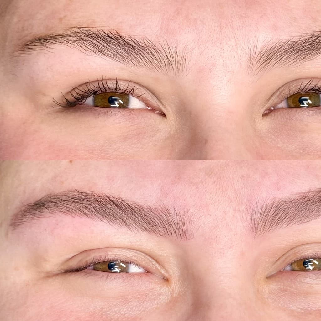 Antes e depois de micropigmentação — caso 5
