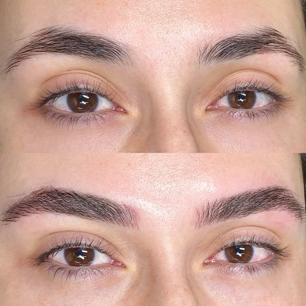 Antes e depois de micropigmentação — caso 6