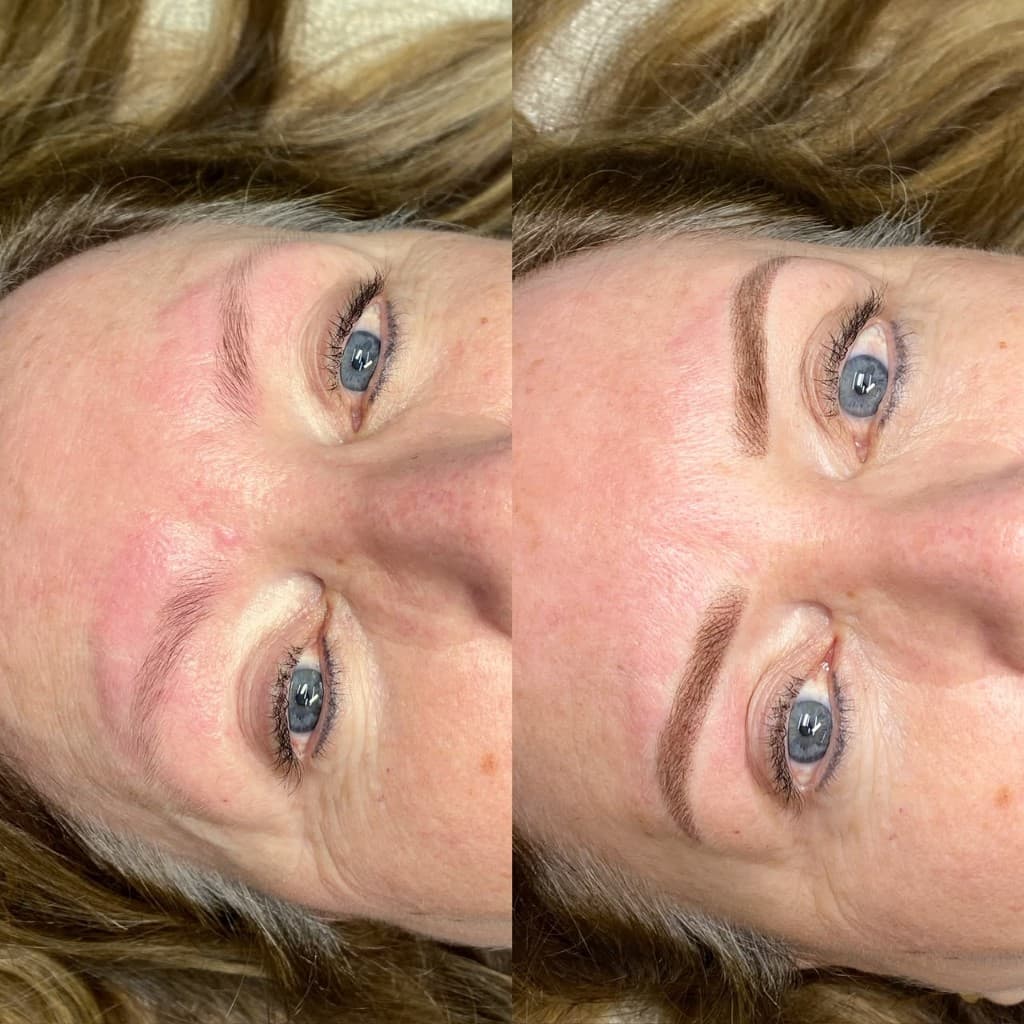 Antes e depois de micropigmentação — caso 7